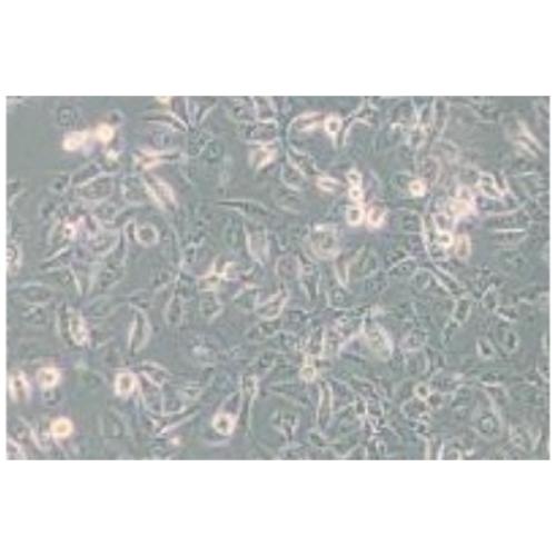 Human Breast Cancer Cell, #SUM149PT