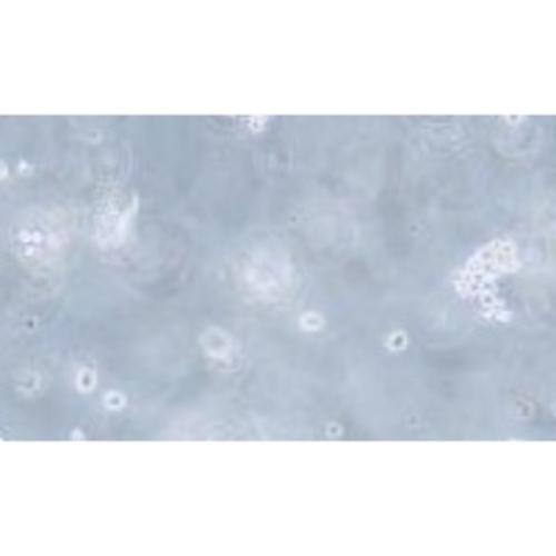 Human Acute Myeloid Leukemia Cell Line, #SKNO-1