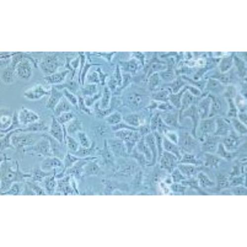 Human Small-Cell Lung Cancer Cell Line, #DMS 114