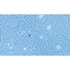 Human Melanoma Cell Line, #A2058
