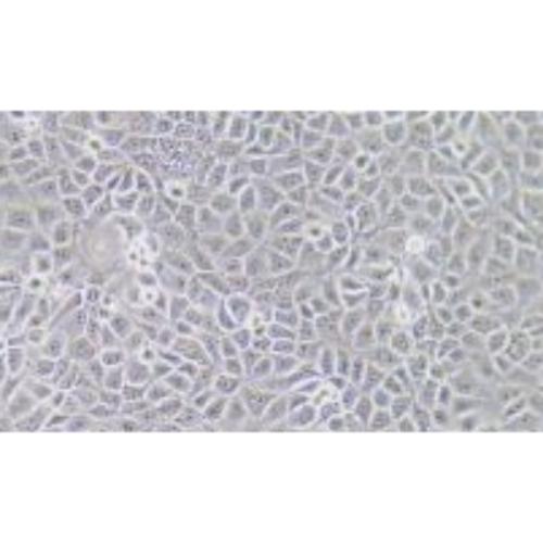 Human Thyroid Carcinoma Cell Line (Undifferentiated), #ACT-1