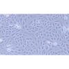 Human Endometrial Adenocarcinoma Cell Line, #AN3CA