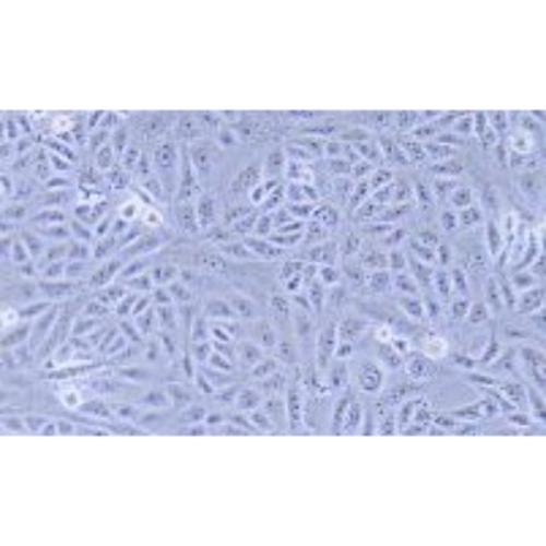 Human Endometrial Adenocarcinoma Cell Line, #AN3CA