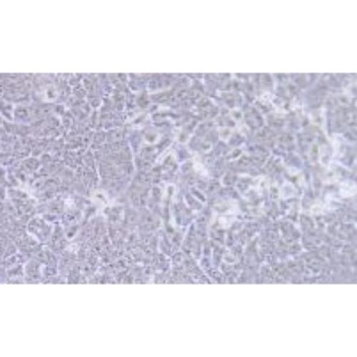 Human Thyroid Cancer Cell Line, #BHT101