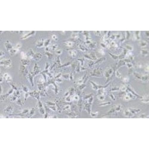 Human Thyroid Carcinoma Cell Line (Undifferentiated), #C643