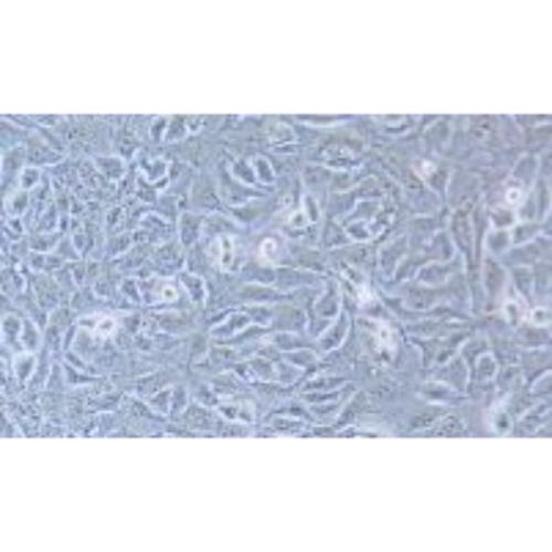 Human Breast Squamous Carcinoma Cell Line, #HCC1806