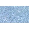 Human Adenocarcinoma Cell Line Of The Lung Cancer, #HCC1833
