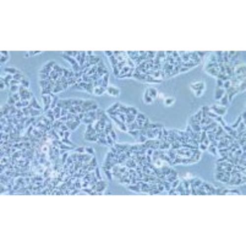 Human Adenocarcinoma Cell Line Of The Lung Cancer, #HCC1833