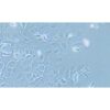 Human Breast Ductal Cancer Cell Line, #HCC1954
