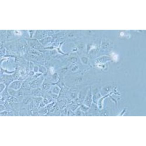 Human Breast Ductal Cancer Cell Line, #HCC1954