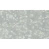 Human B Lymphoblasts, #HMY2.CIR