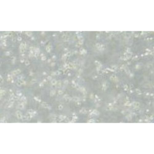 Human B Lymphoblasts, #HMY2.CIR