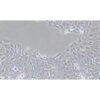 Human Oesophageal Squamous Carcinoma Cell Line, #KYSE-140