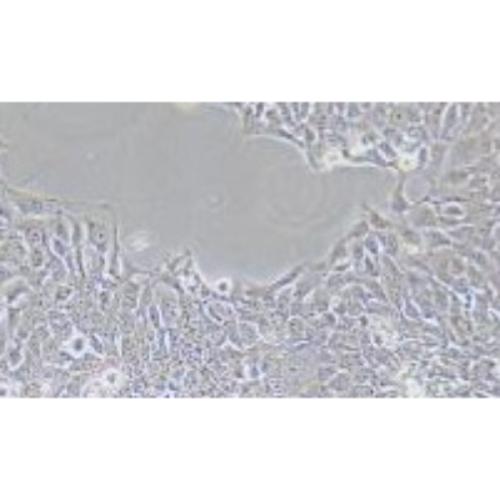 Human Oesophageal Squamous Carcinoma Cell Line, #KYSE-140