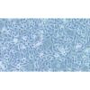 Human Oesophageal Squamous Cell Carcinoma Cell Line, #KYSE-180