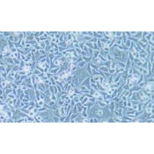 Human Oesophageal Squamous Cell Carcinoma Cell Line, #KYSE-180