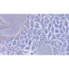 Human Oesophageal Squamous Cell Carcinoma Cell Line, #KYSE-510