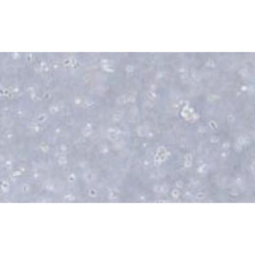 Human Chronic B-Cell Leukemia Cell Line, #MEC-1