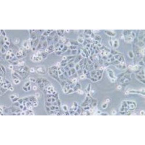 Human Gastric Carcinoma Cell, #MKN-74