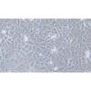 Human Melanoma Cell Line, #MV3