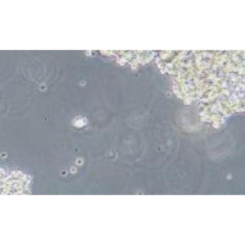 Human Small-Cell Lung Cancer Cell Line, #NCI-H69