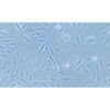 Human Lung Adenosquamous Carcinoma Cell Line, #NCI-H596