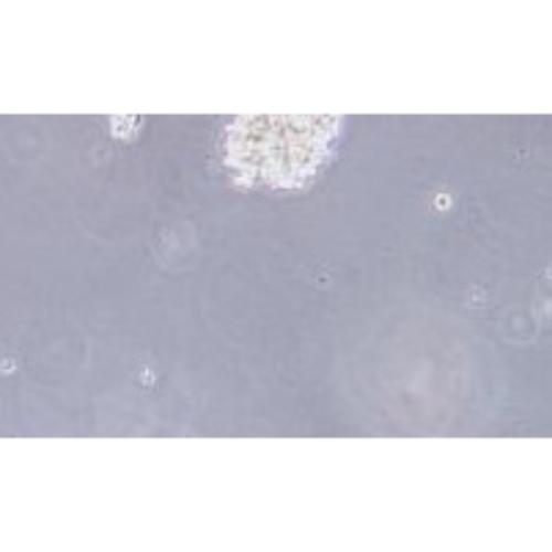 Human Small-Cell Lung Cancer Cell Line, #NCI-H1417