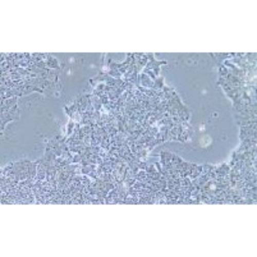 Human Lung Cancer Cell Line, #NCI-H2170