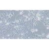 Human Esophageal Cell Line, #OE33