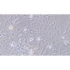 Human Oesophageal Cancer Tumor Cell Line, #SK-GT-4
