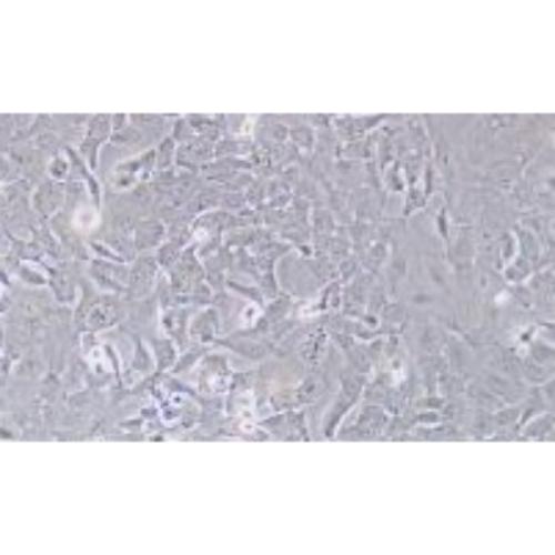 Human Oesophageal Cancer Tumor Cell Line, #SK-GT-4
