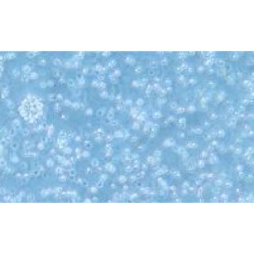 Human B-Cell Lymphoma Cell Line, #SU-DHL-10