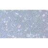 Lung Tatastatic Cell Line In Human Colon Adenocarcinoma, #T84