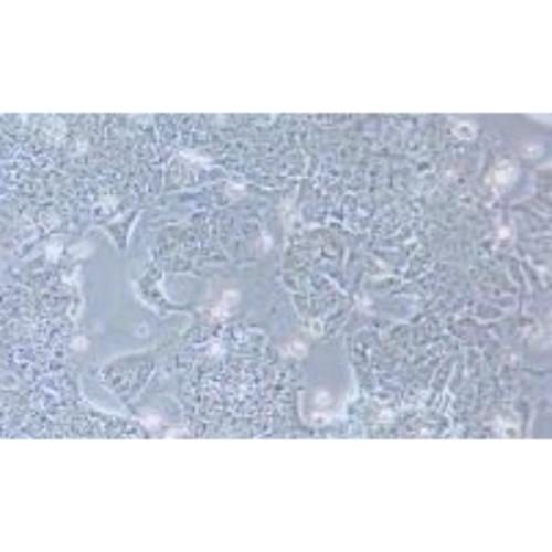 Lung Tatastatic Cell Line In Human Colon Adenocarcinoma, #T84