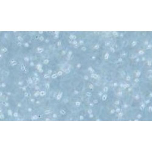 Human, Diffuse Large B-Cell Lymphoma Cell Line, #TOLEDO