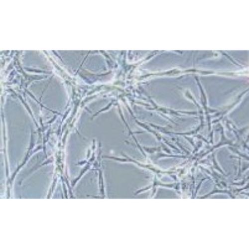Astroglioblastoma Of The Human Brain, Luciferase Labeled #U87MG+LUC