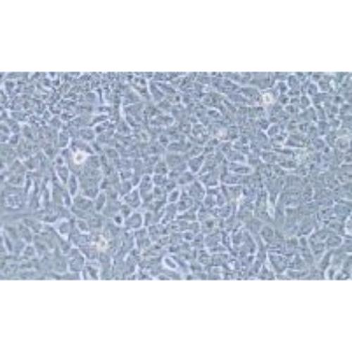 Human Bladder Transitional Cell Carcinoma Cell Line, #KU-19-19