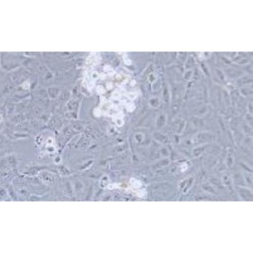 Human Oesophageal Squamous Carcinoma Cell Line, #KYSE-520