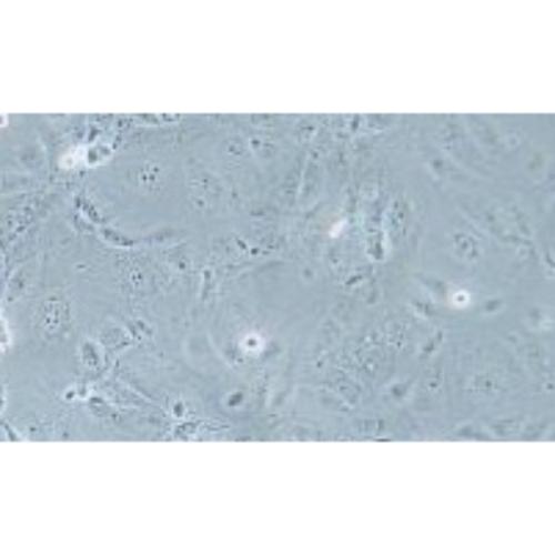 Human Gastric Carcinoma Cell, #MKN-7