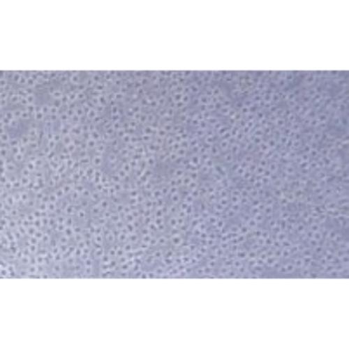 Human Diffuse Large B Lymphoma Cell Line, #OCI-LY10
