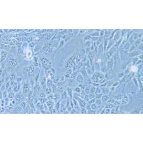 Human Pancreatic Cancer Cell Line, #PANC 08.13