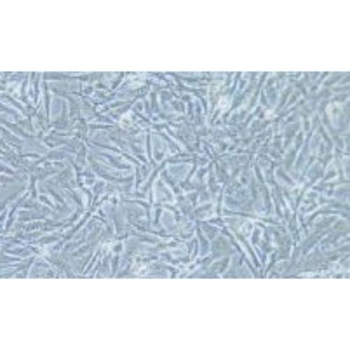 Human Breast Cancer Cell, #SUM159PT