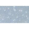 Human Esophageal Cancer Cell Line, #TE-10