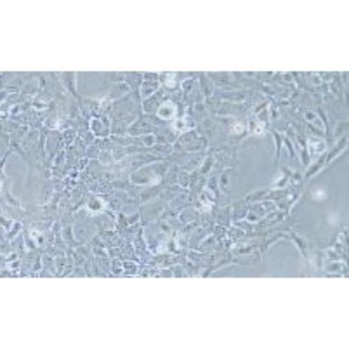 Human Esophageal Cancer Cell Line, #TE-10