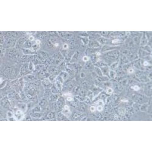 Human Thyroid Carcinoma Cell Line (Undifferentiated), #TTA1