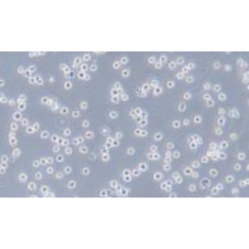 Human Diffuse Large B Lymphoma Cell Line, #WSU-DLCL2