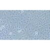 Human Breast Cancer Cell, #AU565