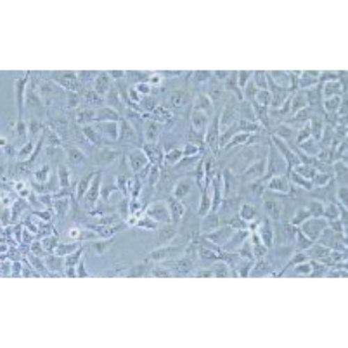 Human Breast Cancer Cell, #AU565