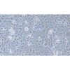 Human Non-Small-Cell Lung Cancer Cell Line, #NCI-H1568