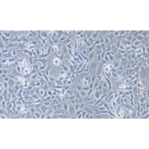 Human Non-Small-Cell Lung Cancer Cell Line, #NCI-H1568